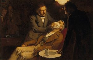 V0018140 The first use of ether in dental surgery, 1846. Oil painting Credit: Wellcome Library, London. Wellcome Images images@wellcome.ac.uk http://images.wellcome.ac.uk The first use of ether in dental surgery, 1846. Oil painting by Ernest Board. By: Ernest BoardPublished: - Copyrighted work available under Creative Commons by-nc 2.0 UK, see http://images.wellcome.ac.uk/indexplus/page/Prices.html